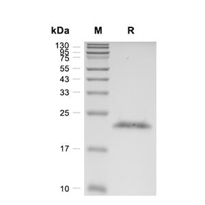 Alpha-crystallin A chain/CRYAA蛋白, Human (His)