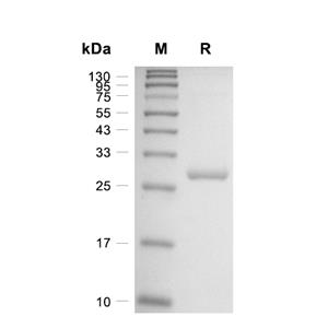 PPAR gamma蛋白, Human (His)