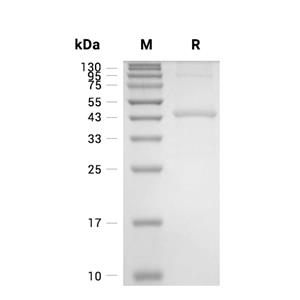 ACTB蛋白, Human (His)