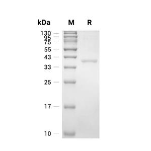 Biliverdin Reductase A/BLVRA蛋白, Human (C-His)