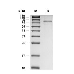 Cadherin-11蛋白, Human (HEK293, His)