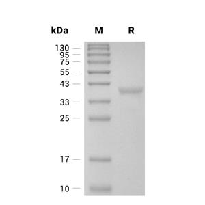 Arginase-1/ARG1蛋白, Human (C-His)