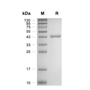 GOT1蛋白, Human (His)
