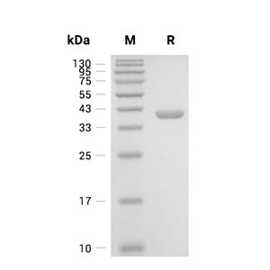 D-amino-acid oxidase/DAO蛋白, Human (His)