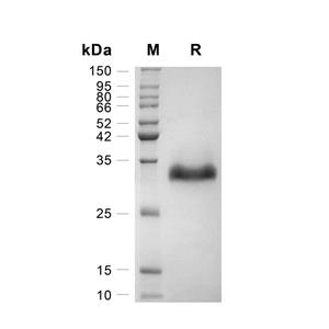 Angiopoietin-2蛋白, Human (222a.a, HEK293, His),Angiopoietin-2 Protein, Human (222a.a, HEK293, His)