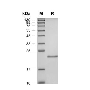 Kras4B蛋白, Human (G12S, His),Kras4B Protein, Human (G12S, His)