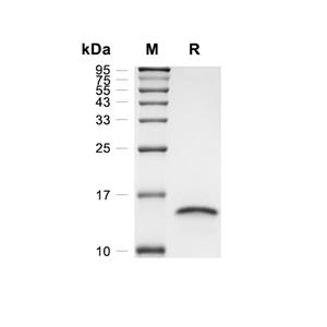 Nucleocapsid蛋白 NTD domain, Virus (His)