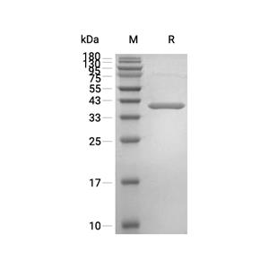 Aldose 1-epimerase/GALM蛋白, Human (His)