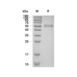 ACVRL1/ALK1蛋白, Mouse (HEK293, Fc),ACVRL1/ALK1 Protein, Mouse (HEK293, Fc)