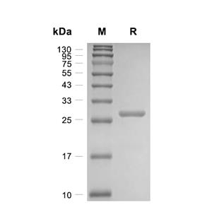 BCAS2蛋白, Human (His, T7),BCAS2 Protein, Human (His, T7)