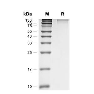 Collagen alpha-1(III) chain/COL3A蛋白, Mouse (HEK293, His)