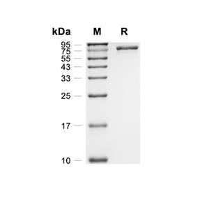 Vitronectin蛋白, Human (HEK293, His)