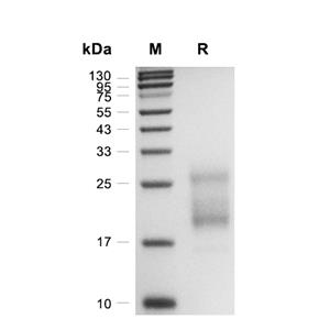 Irisin蛋白, Human/Mouse/Rat (HEK293, His),Irisin Protein, Human/Mouse/Rat (HEK293, His)