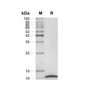 LR3 IGF-I/IGF-1蛋白, Human (83a.a, E51R)