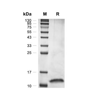 TGF beta 1/TGFB1蛋白, Human (HEK293),TGF beta 1/TGFB1 Protein, Human (HEK293)