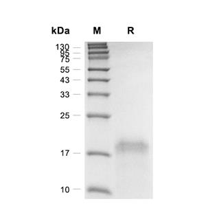 PDGF-AA蛋白, Human