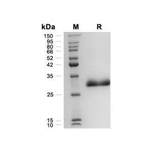 Noggin蛋白, Human (HEK293)
