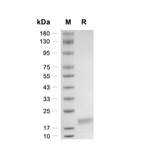IL-4蛋白, Human (HEK293)