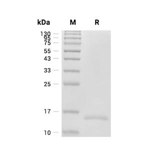 TNF-alpha/TNFSF2蛋白, Mouse (147a.a)