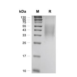 M-CSF蛋白, Mouse (HEK293),M-CSF Protein, Mouse (HEK293)