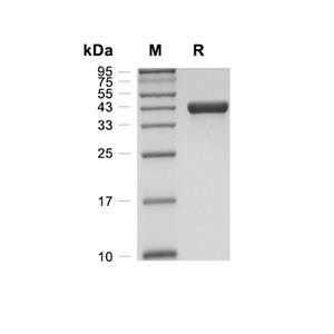 SPARC蛋白, Human (HEK293, His)