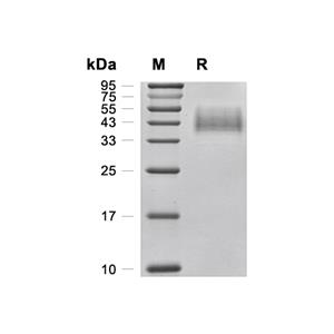 TROP-2蛋白, Human (248a.a, HEK293, His)
