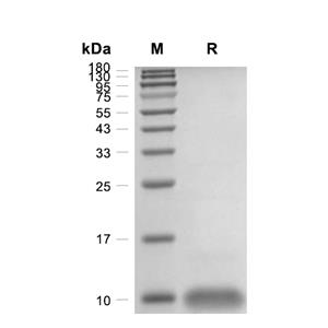 RANTES/CCL5蛋白, Human