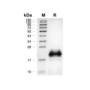 IL-4蛋白, Human (HEK293, His),IL-4 Protein, Human (HEK293, His)