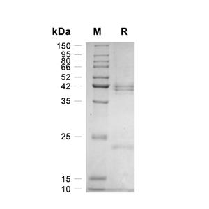 IL-12蛋白, Mouse (HEK293)