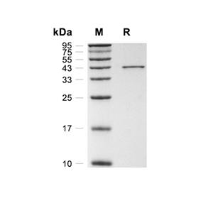 IDO-1蛋白, Human (His)