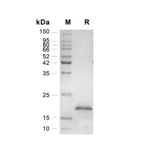 IL-10蛋白, Human (HEK293)