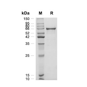 MMP-2蛋白, Human (HEK293, His)