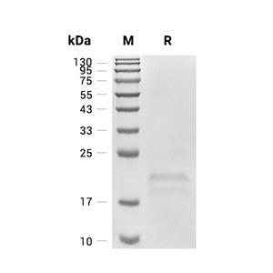 CD3 epsilon蛋白, Human (HEK293, His)