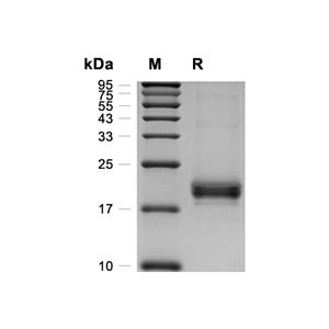 IL-17F蛋白, Human (HEK293, His)