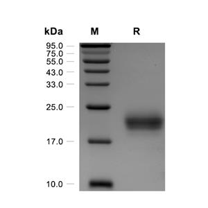 IL-5蛋白, Human (HEK293, His),IL-5 Protein, Human (HEK293, His)