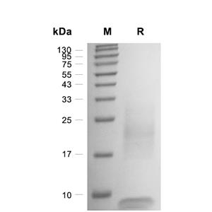 TSLP蛋白, Human (HEK293, His),TSLP Protein, Human (HEK293, His)
