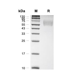 PVR/CD155蛋白, Human (HEK293, His)