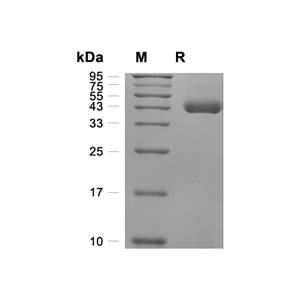 Renin蛋白, Human (HEK293, His),Renin Protein, Human (HEK293, His)