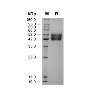 Irisin蛋白, Human/Mouse/Rat (HEK293, Fc)