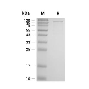 GAS6蛋白, Human (HEK293, Fc)