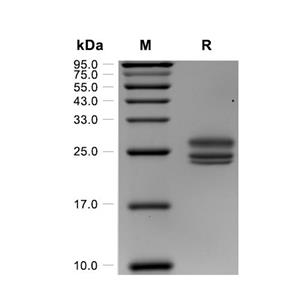 Prolactin蛋白, Human (HEK293, His),Prolactin Protein, Human (HEK293, His)
