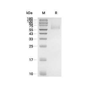 Vaspin蛋白, Human (HEK293, His)