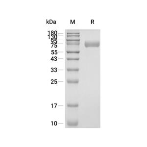 Hemopexin蛋白, Mouse (HEK293, His, solution)