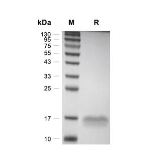TFF1蛋白, Mouse (HEK293, His)