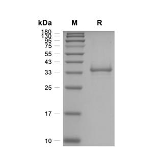 SP-10/ACRV1蛋白, Human (HEK293, C-His),SP-10/ACRV1 Protein, Human (HEK293, C-His)