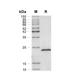 TIMP-2蛋白, Mouse (HEK293, His)