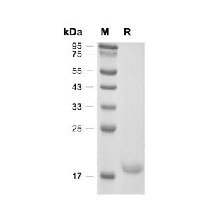 SNCA蛋白, Human (His)