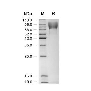 GPNMB/Osteoactivin蛋白, Human (HEK293, His)