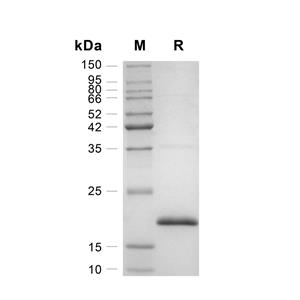 FGF basic/bFGF蛋白, Human (157a.a)