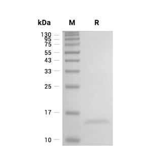 Galectin-1/LGALS1蛋白, Human (His),Galectin-1/LGALS1 Protein, Human (His)